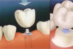Dental Treatment Romania