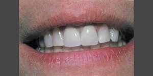 Dental-Treatment06