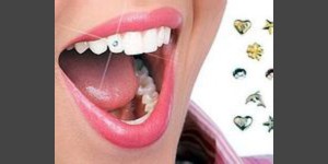 Dental-Treatment07